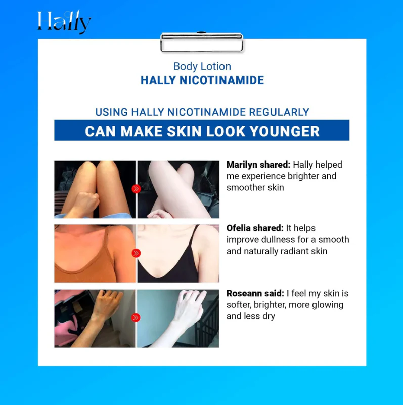 đ„Original Hally Niacinamide Whitening Body Lotionđ„